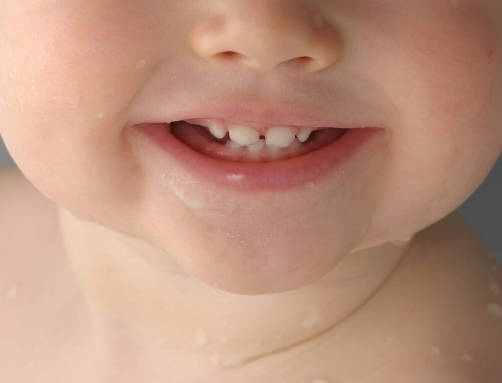Deťom sa zuby kazia menej ako pred 10 rokmi