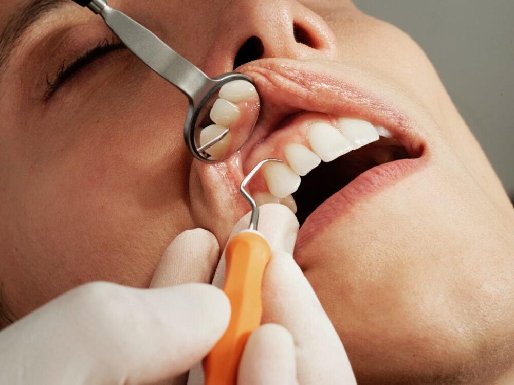 Liek na opätovný rast zubov? Vedci to otestujú na ľuďoch. „Sen každého zubára“