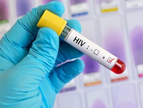 Americké úrady identifikovali prvý zdokumentovaný prípad HIV prenesený kozmetickými ihlami