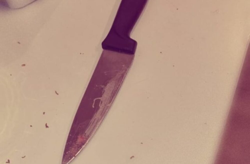 33773_452702807_799346089059493_7845490652406259819_n-e1721907644481-640x420.jpg Krvavá hádka na ubytovni, opitá žena nožom pobodala muža