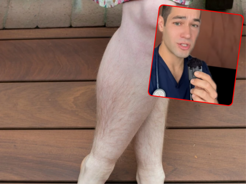 Lekár hovorí, že by ste sa nemali holiť. Uviedol silný argument