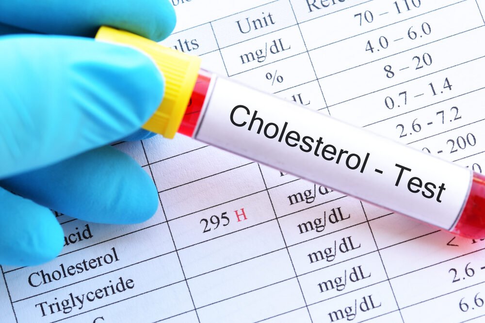 Pite to každý deň a váš cholesterol bude dokonalý. Výsledky testov prekvapia aj lekára