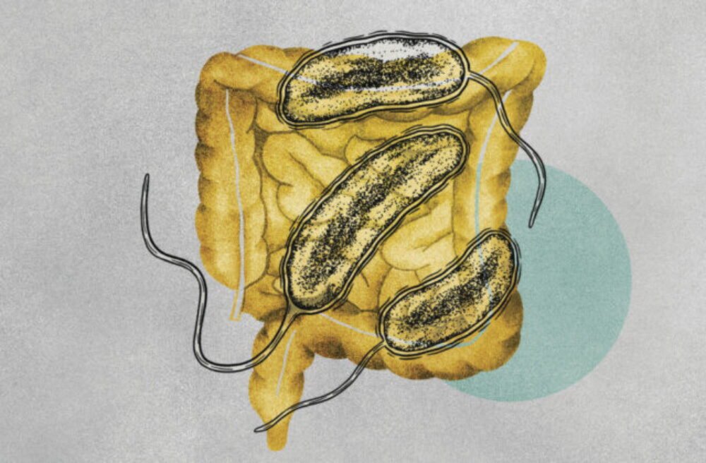 V Poľsku potvrdili prípad nákazy cholerou