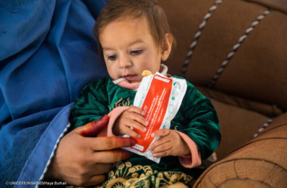 51794_uni540603-640x420.jpg Zbierka Modrý gombík UNICEF 2025: Slovensko pomohlo zachrániť 2 530 podvyživených detí